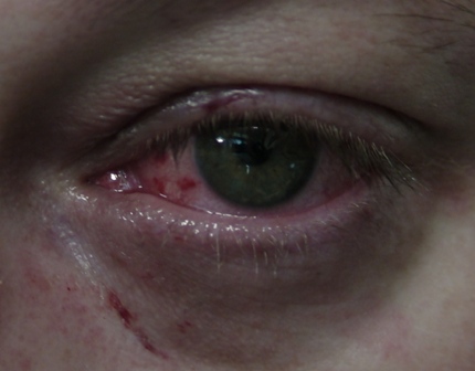 my eye.jpg