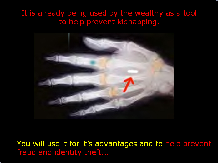 inserted in hand.jpg